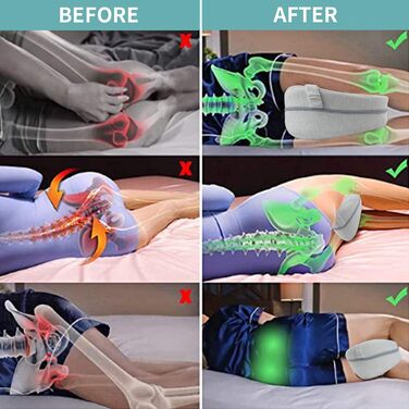 Подушка для коліна CREATESTAR для сну на боці, подушка для ніг, ергономічна подушка для сну на боці з оптимальною колінною піною з ефектом пам&39яті для позиціонування подушки зі знімним та пральним чохлом, світло-сірий дизайн із серцем