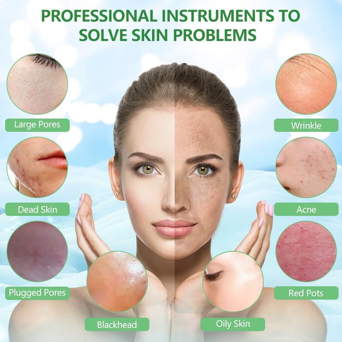 Скраб для шкіри ACWOO, пристрій для ультразвукового пілінгу для обличчя, ультразвуковий пристрій для обличчя для сяючої шкіри, лопатка для обличчя для видалення чорних крапок, засіб для очищення пір зелений