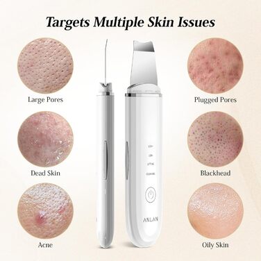 Ультразвуковий пілінговий пристрій ANLAN Скраб для шкіри, ультразвуковий пілінг для очищення пір, засіб для видалення прищів, іонний очищувач шкіри для очищення обличчя, догляд за обличчям, догляд за обличчям (білий)