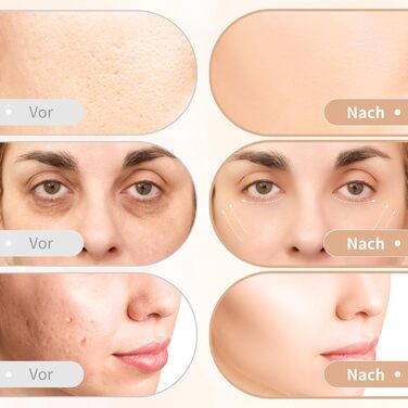 Масажер для обличчя проти зморшок 5 в 1 радіочастотний пристрій для обличчя з 2 світлодіодними світлотерапією RF вібрація іон для боротьби зі зморшками і старінням видалення вугрів глибоке очищення догляд за обличчям