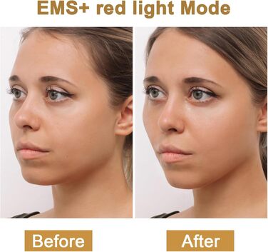 Радіочастотний пристрій Cozion для обличчя EMS пристрій для підтяжки обличчя 5 в 1 RF радіочастотний пристрій для обличчя зі світлодіодною світлотерапією Використовується для підтяжки шкіри та зменшення зморшок