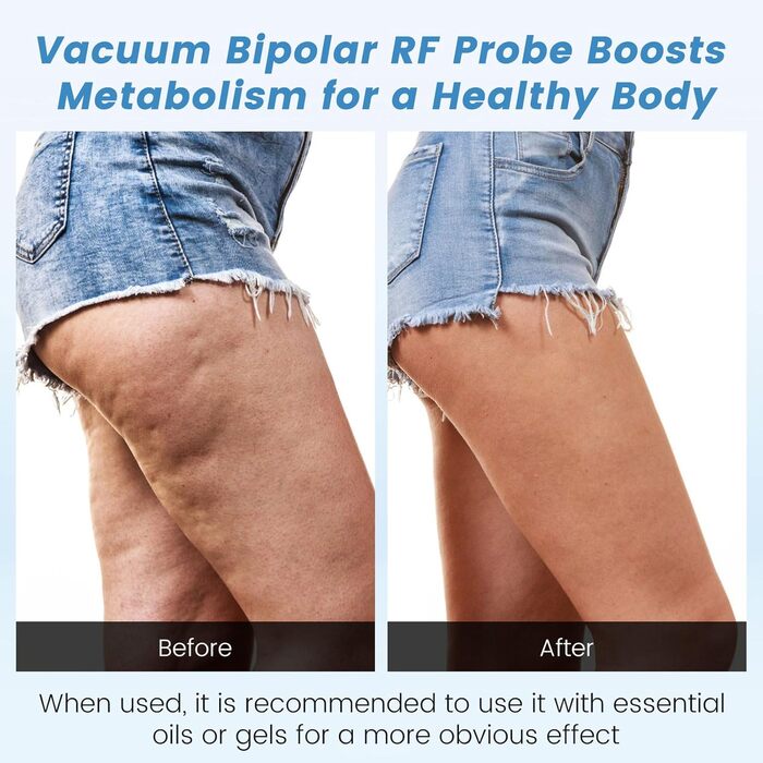 Масажер від целюліту Cozion 40K для схуднення 4 в 1 радіочастотна машина краси для обличчя та тіла, що зміцнює та моделює підтяжку шкіри