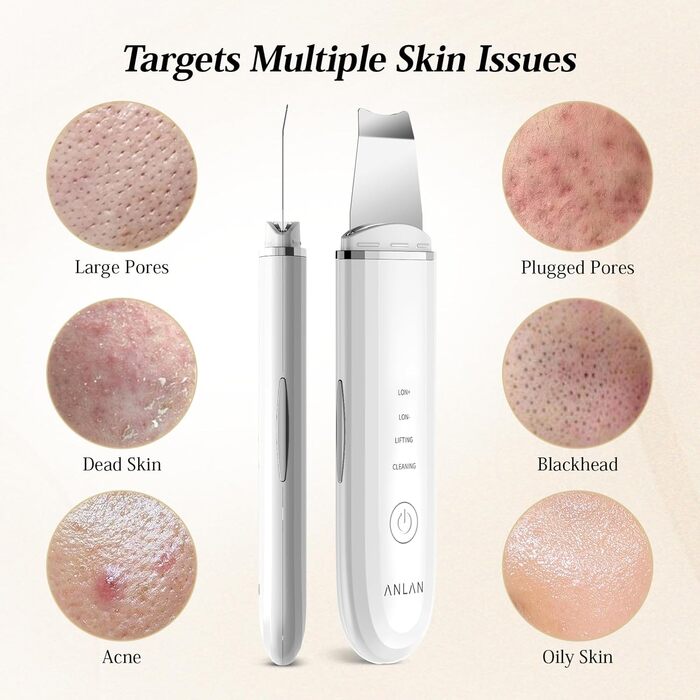 Ультразвуковий пілінговий пристрій ANLAN Скраб для шкіри, ультразвуковий пілінг для очищення пір, засіб для видалення прищів, іонний очищувач шкіри для очищення обличчя, догляд за обличчям, догляд за обличчям (білий)