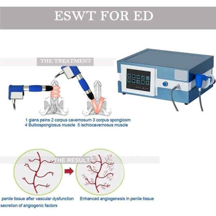 Пристрій для ударно-хвильової терапії ED Пристрій для ударно-хвильової терапії Фізіотерапевтичний апарат Пневматичний екстракорпоральний пристрій для ударно-хвильової терапії Пристрій для терапії Полегшення болю Масаж Еректильна дисфункція