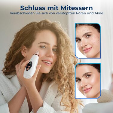 Засіб для очищення пор обличчя, засіб для видалення пор, засіб для очищення обличчя, засіб для видалення чорних крапок, пристрій для очищення обличчя, масажер для обличчя, очищення обличчя, догляд за шкірою, із захисною маскою