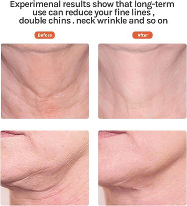 Електричний масажер для обличчя Ms.W проти старіння, масажер для обличчя проти зморшок, масажер для обличчя проти зморшок, масажер для обличчя проти зморшок, вібраційний масаж обличчя, пристрої для краси обличчя, 3 режими золотого масажера для обличчя