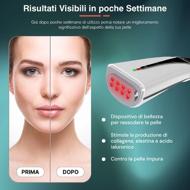 Омолоджуючий і зміцнювальний пристрій проти зморшок для шкіри, високоефективний 240 В - передова технологія для домашнього догляду - ідеально підходить для вашого режиму догляду за шкірою