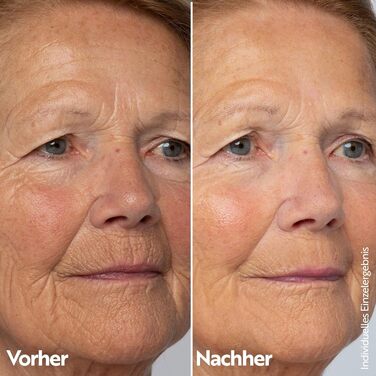 М. Asam RETINOL INTENSE Нічний крем для інтенсивної корекції зморшок (50 мл) Антиейдж крем з ретинолом для інтенсивного нічного догляду, помітного зменшення зморшок та ефективного догляду за зрілою шкірою обличчя ()