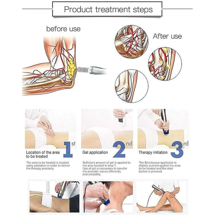 Апарат для ударно-хвильової терапії, масажер для полегшення болю, професійний ударно-хвильовий апарат для терапії, полегшення болю, корекції фігури та лікування ED за допомогою таблеток