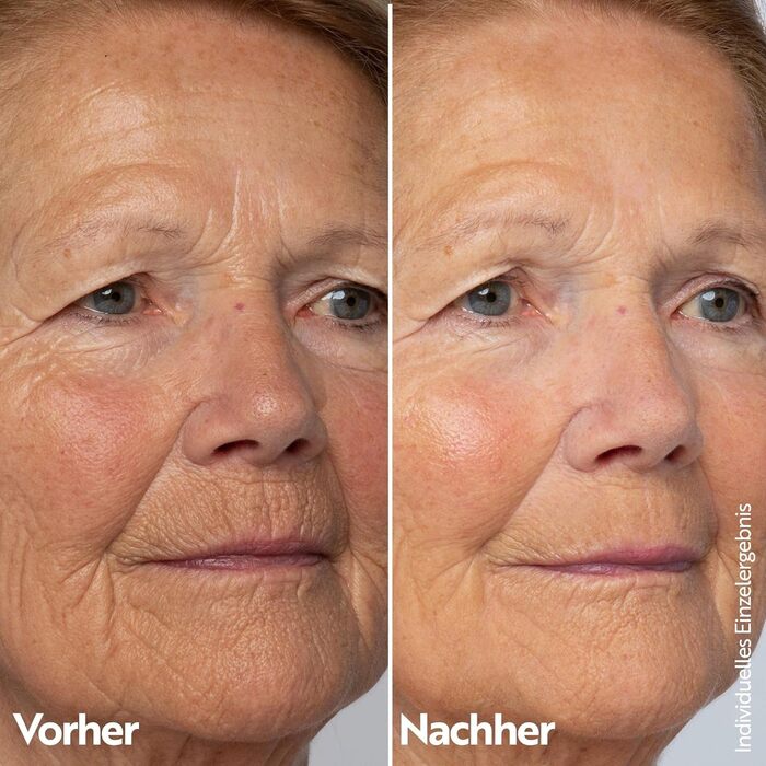 М. Asam RETINOL INTENSE Нічний крем для інтенсивної корекції зморшок (50 мл) Антиейдж крем з ретинолом для інтенсивного нічного догляду, помітного зменшення зморшок та ефективного догляду за зрілою шкірою обличчя ()