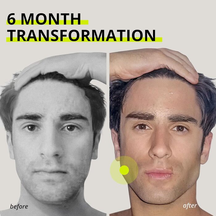 Жувальна гумка без цукру з імбиром та лаймом. Тренажер для підтягування щелепи. Жувальна гумка для формування щелепи (2 місяці упаковки)