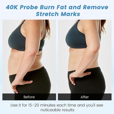 Масажер від целюліту Cozion 40K для схуднення 4 в 1 радіочастотна машина краси для обличчя та тіла, що зміцнює та моделює підтяжку шкіри