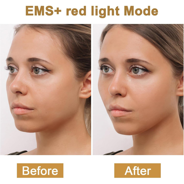 Радіочастотний пристрій Cozion для обличчя EMS пристрій для підтяжки обличчя 5 в 1 RF радіочастотний пристрій для обличчя зі світлодіодною світлотерапією Використовується для підтяжки шкіри та зменшення зморшок