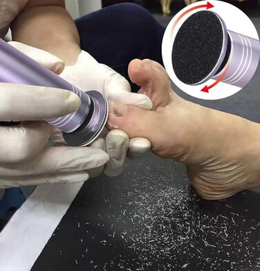 Електрична пилка для видалення мозолів з регульованою швидкістю для професійного педикюру зі змінними пилками для мертвої жорсткої потрісканої шкіри, зі змінною шліфувальною подушечкою 60 шт. (сіра)