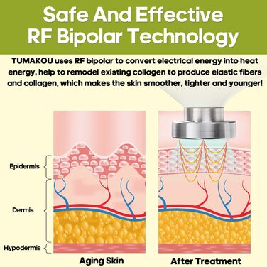 Радіочастотний пристрій TUMAKOU RF з - для омолодження шкіри, видалення зморшок, боротьби зі старінням, підтяжки шкіри - апарати для краси для обличчя