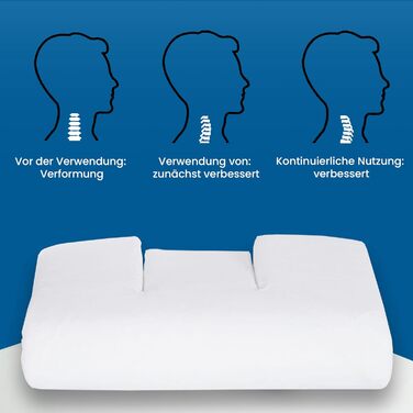 Ортопедична подушка підвищеного комфорту The Pillow - Унікальна 3-складова конструкція для підтримки природної S-подібної форми - Зменшує біль у шиї та спині - Покращена вентиляція Від 65 кг підвищеного комфорту