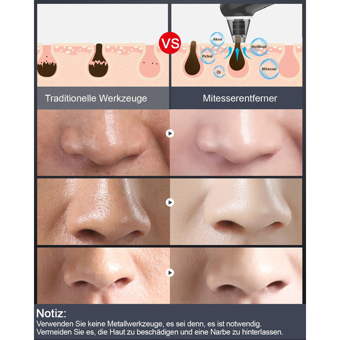 Очищувач пір для видалення вугрів вакуумний очищувач пір для обличчя Очищувач пір для видалення вугрів вакуумний очищувач 4 всмоктувальні головки 3 режими USB зарядка для очищення обличчя вакуумний очищувач пір для видалення прищів Пристрій для видалення 