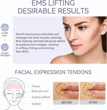 Масажер для обличчя, ANLAN 5 в 1 масажер для обличчя проти зморшок Червоний і синій світловий терапевтичний масажер для обличчя Тепло прохолодна вібрація EMS пристрій для обличчя Підтяжка обличчя проти зморшок антивіковий пристрій класичний
