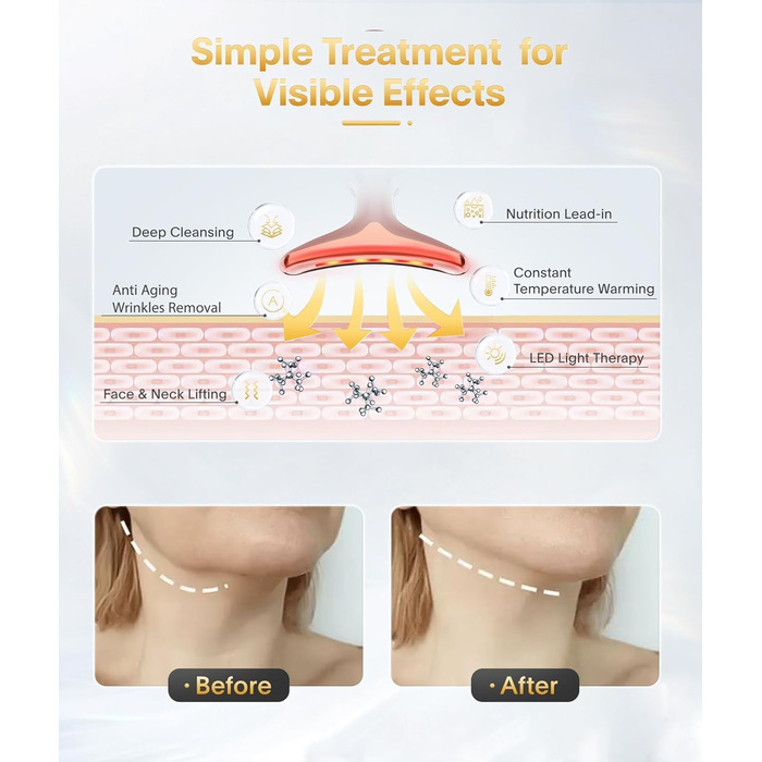 Електричний масажер для обличчя Leotop, косметичний пристрій для обличчя та шиї, пристрій для обличчя Face Beauty Meter для підтяжки та підтяжки шкіри, масажний обігрівач EMS проти зморшок. (7 режимів освітлення з рожевого золота)