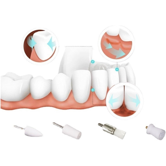 Багатофункціональний електричний полірувальник зубів JUANZD, відбілююча чистка зубів, 3 рівні вібрації, видалення міжзубних плям, 4 змінні головки, полірування зубів (groen)
