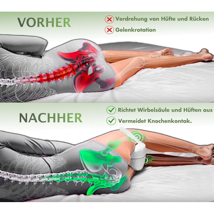 Подушка для коліна MillyBeas для сну на боці - ортопедична подушка для ніг з піни з ефектом пам&39яті, розроблена лікарями, зі знімним бамбуковим чохлом для полегшення болю в спині/стегнах/суглобах та сідничному нерві