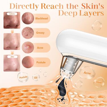 Видалення чорних крапок пилосос для очищення пір пилосос для очищення пір 4 режими прищів пилосос для очищення обличчя лікування вугрів догляд за шкірою пилосос для видалення чорних крапок догляд за шкірою