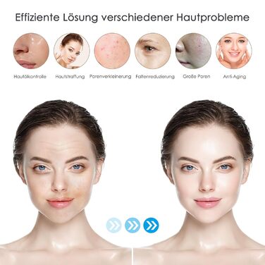 Ручка H3 Автоматичне нанесення сироватки Dr pen Microneedling Pen Dermapen Для догляду за шкірою та росту волосся З 5 картриджами (12/24/36 голок,Nano-R,Nano-S) Bestuaty X Hydra. Ручка - подарунки жінкам