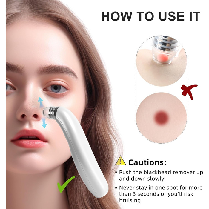 Пилосос для очищення пір з камерою 1080P HD, вакуумний пилосос для видалення чорних крапок з 4 всмоктувальними головками, 5 всмоктувальними силами для очищення шкіри обличчя від прищів і вугрів Whitehead Whitehead Білий