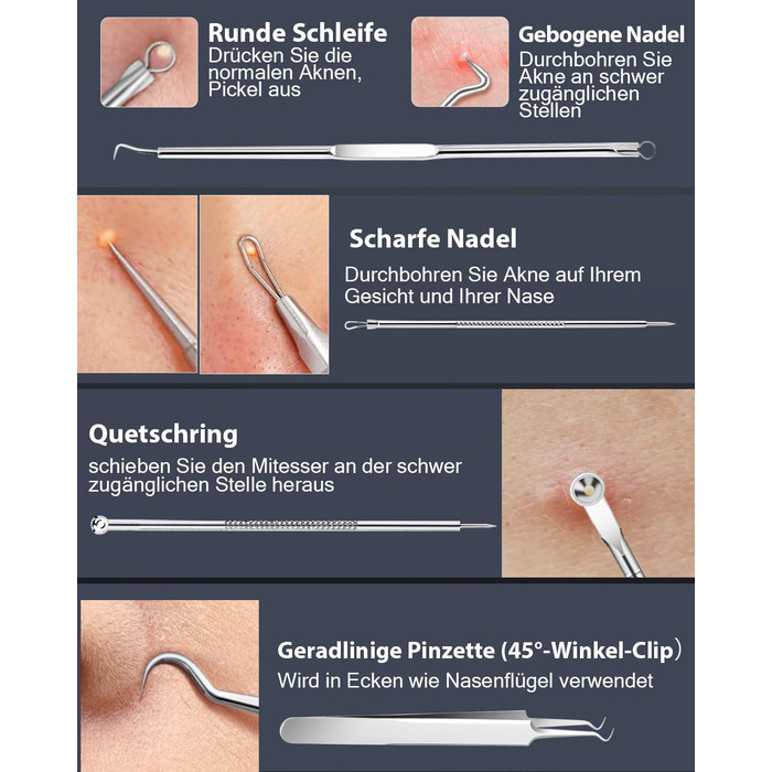 Очищувач пір для видалення вугрів вакуумний очищувач пір для обличчя Очищувач пір для видалення вугрів вакуумний очищувач 4 всмоктувальні головки 3 режими USB зарядка для очищення обличчя вакуумний очищувач пір для видалення прищів Пристрій для видалення 