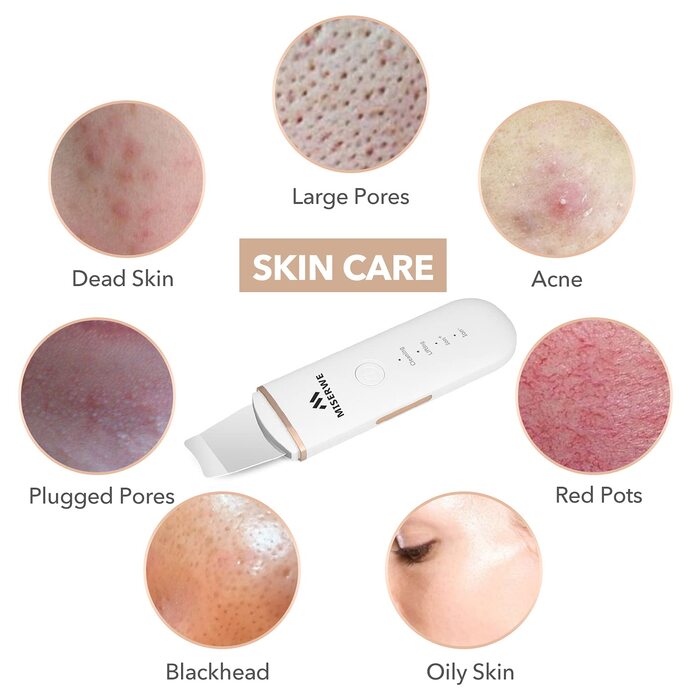Скраб для шкіри Шпатель для шкіри обличчя Ультразвуковий пілінг Пристрій для очищення шкіри Скраб для видалення чорних крапок Очищувач пір Інструмент для видалення чорних крапок для глибокого очищення