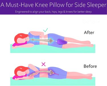 Подушка для підтримки колін - Надувна клиноподібна подушка, Портативна подушка для колін між ногами для сну - Подушка для ніг, Заспокійливе знеболення при ішіасі, кульшових суглобах та стегнах, Підтримка сну