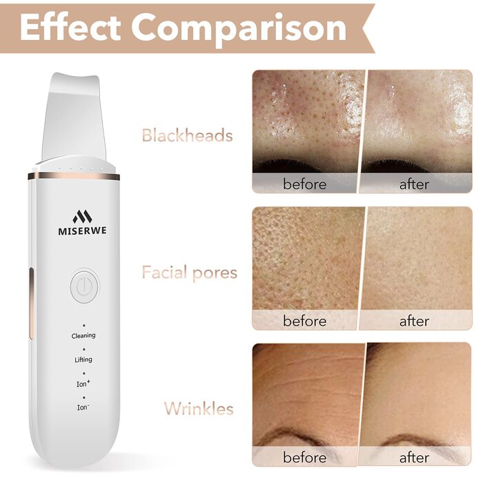 Скраб для шкіри Шпатель для шкіри обличчя Ультразвуковий пілінг Пристрій для очищення шкіри Скраб для видалення чорних крапок Очищувач пір Інструмент для видалення чорних крапок для глибокого очищення