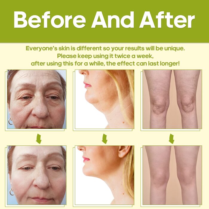 Радіочастотний пристрій TUMAKOU RF з - для омолодження шкіри, видалення зморшок, боротьби зі старінням, підтяжки шкіри - апарати для краси для обличчя