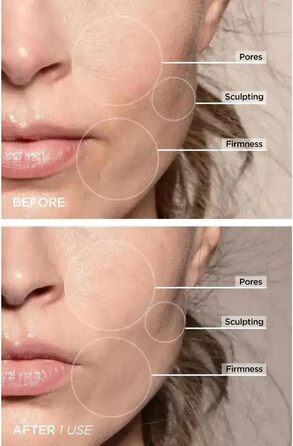 Масажер для обличчя проти зморшок, пристрій для краси обличчя з 7 режимами, пристрій для обличчя для підтяжки шкіри та ліфтингу Ems масаж обличчя (чорний), 7-in-1 Led Facialsculptor Original