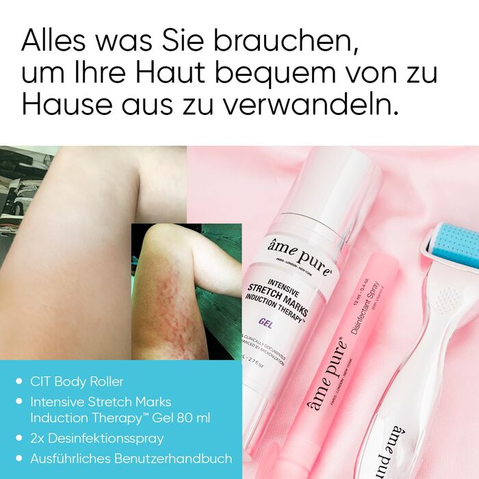Набір AME PURE Body Roller для видалення розтяжок, 0,75 мм - Ефект від використання CIT Body Roller можна порівняти з ефектом від лазерних процедур на шкірі