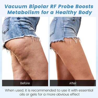 Масажер від целюліту Cozion 40K для схуднення 4 в 1 радіочастотна машина краси для обличчя та тіла, що зміцнює та моделює підтяжку шкіри