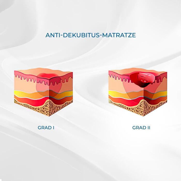 Протипролежневий матрац, Mobi 2, Для пролежнів I та II ступеня, Зі змінним повітрям, Самонадувальний надувний матрац, Повітряна подушка, 200 x 86 см, 9,5 см, 20 комірок, Колір синій
