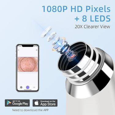 Пилосос для очищення пір з камерою 1080P HD, вакуумний пилосос для видалення чорних крапок з 4 всмоктувальними головками, 5 всмоктувальними силами для очищення шкіри обличчя від прищів і вугрів Whitehead Whitehead Білий