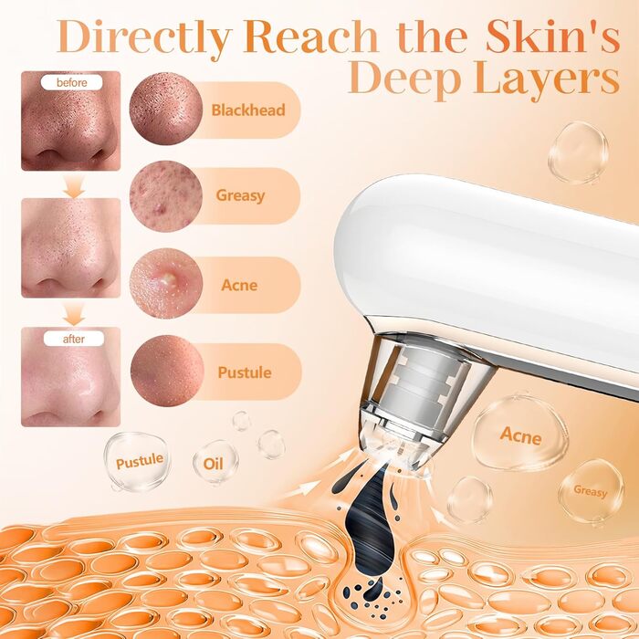 Видалення чорних крапок пилосос для очищення пір пилосос для очищення пір 4 режими прищів пилосос для очищення обличчя лікування вугрів догляд за шкірою пилосос для видалення чорних крапок догляд за шкірою