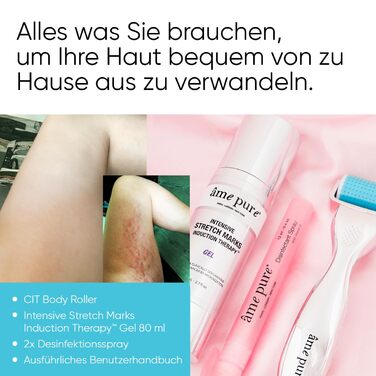 Набір AME PURE Body Roller для видалення розтяжок, 0,75 мм - Ефект від використання CIT Body Roller можна порівняти з ефектом від лазерних процедур на шкірі