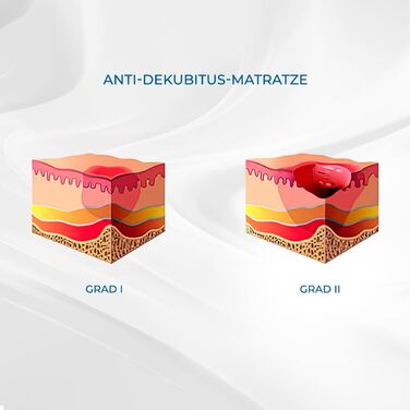 Протипролежневий матрац, Mobi 2, Для пролежнів I та II ступеня, Зі змінним повітрям, Самонадувальний надувний матрац, Повітряна подушка, 200 x 86 см, 9,5 см, 20 комірок, Колір синій
