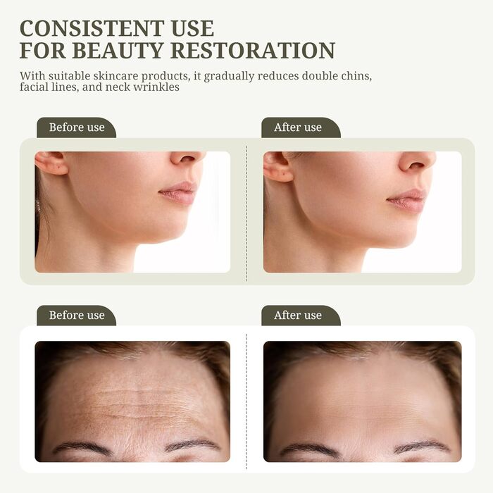 Масажер для обличчя проти зморшок 4 в 1 Пристрій для краси обличчя електричний EMS V Face Пристрій для підтяжки обличчя з 43 тепловим світлодіодом і вібрацією для підтяжки та підйому шкіри USB Перезаряджається