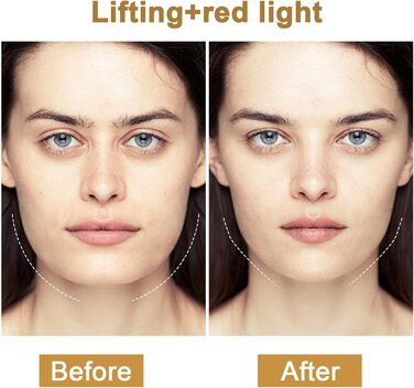 Радіочастотний пристрій Cozion для обличчя EMS пристрій для підтяжки обличчя 5 в 1 RF радіочастотний пристрій для обличчя зі світлодіодною світлотерапією Використовується для підтяжки шкіри та зменшення зморшок