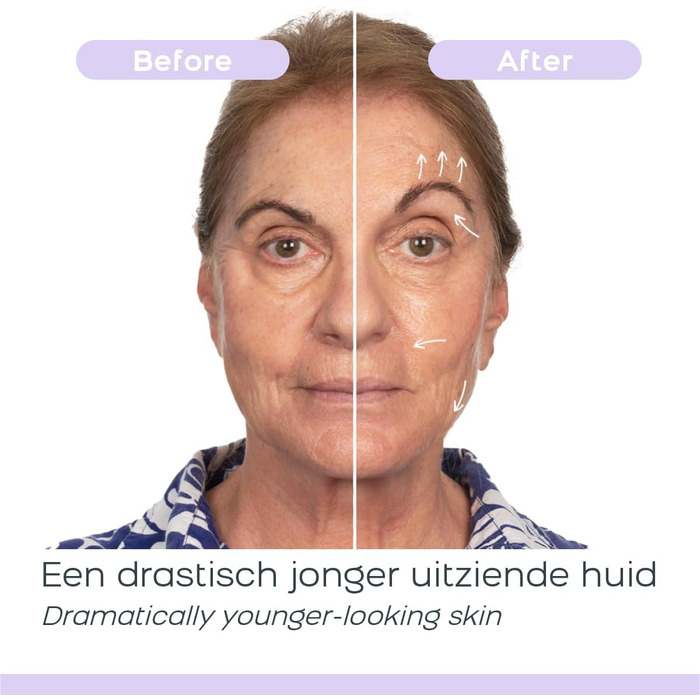 Пристрій для догляду за шкірою