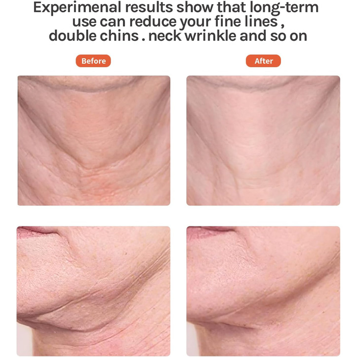 Електричний масажер для обличчя Ms.W проти старіння, масажер для обличчя проти зморшок, масажер для обличчя проти зморшок, масажер для обличчя проти зморшок, вібраційний масаж обличчя, пристрої для краси обличчя, 3 режими золотого масажера для обличчя