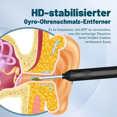 Отоскоп для видалення вушної сірки, камера для чищення вух AMDXD WiFi 8MP HD вушна камера IP4 Водонепроникний вушний отоскоп, камера отоскопа з широким кутом огляду 360, 6 світлодіодів для iPhone, iPad і смартфонів Android, чорний