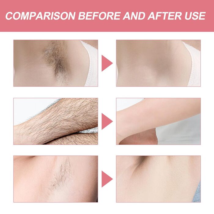 Пінка для видалення волосся Belle Body, крем-спрей для видалення волосся Gentle Honey Mousse, спрей для видалення волосся з бджолиного воску, пінка для депіляції спрей для видалення волосся для жінок і чоловіків (2 шт. )