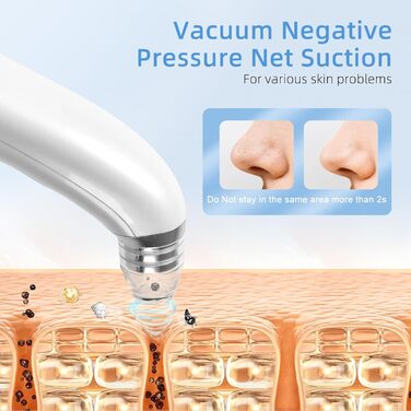 Пилосос для очищення пір з камерою 1080P HD, вакуумний пилосос для видалення чорних крапок з 4 всмоктувальними головками, 5 всмоктувальними силами для очищення шкіри обличчя від прищів і вугрів Whitehead Whitehead Білий