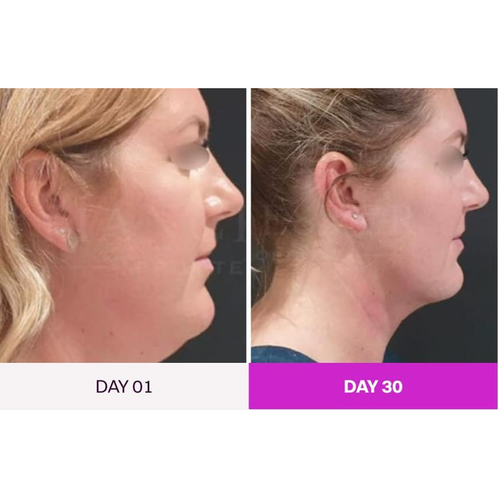 Масажер для обличчя проти зморшок, пристрій для краси обличчя з 7 режимами, пристрій для обличчя для підтяжки шкіри та ліфтингу Ems масаж обличчя (чорний), 7-in-1 Led Facialsculptor Original