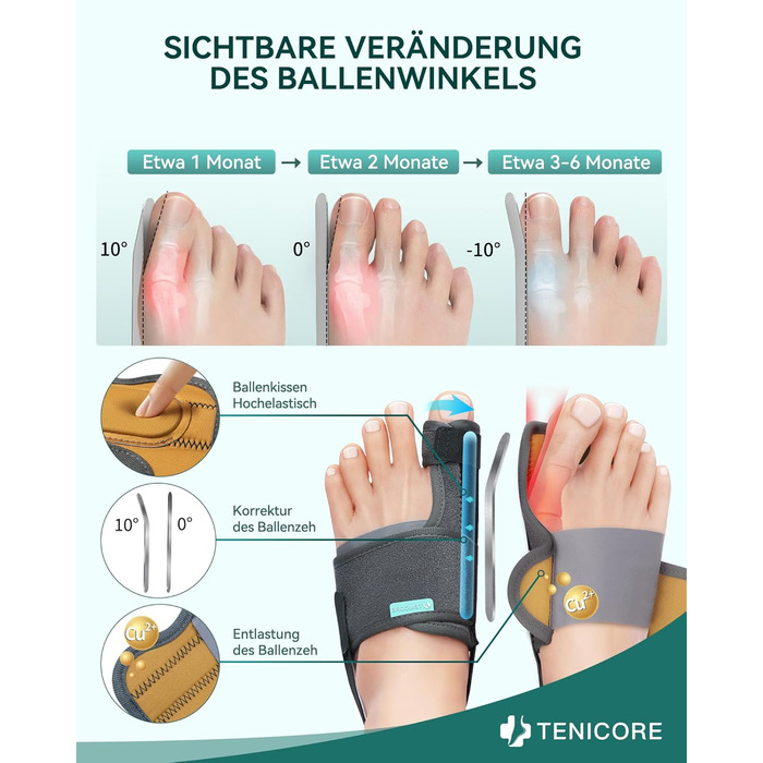 Покращує корекцію Hallux Valgus за допомогою 2 кутових прасок, потовщених силіконових накладок, розширювача пальців ніг, 1 пара шкарпеток-бандажів для Hallux Valgus